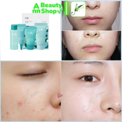 Kit cho da mụn Hanyul Mentha Trouble Skincare Kit
