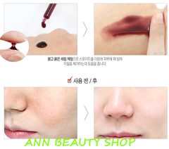 Sample Red Peel - Tẩy tế bào chết hoá học