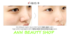 Sample Red Peel - Tẩy tế bào chết hoá học