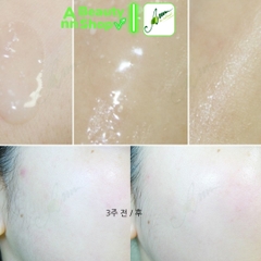 Tinh Chất AMPLE:N Ampoule Coreana