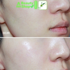 Set Serum Time Revolution Regenerating Royal Serum Capsule 2ml *10 viên