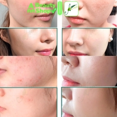 Sữa Rửa Mặt AHA BHA PHA Some By Mi 100ml
