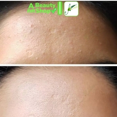 Tẩy Da Chết Hóa Học COSRX BHA Blackhead Power Liquid 100ml/  Cosrx AHA 7 Whitehead Power Liquid 100ml