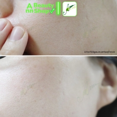 Tẩy da chết Prreti Clear Mild Peeling Gel 200ml