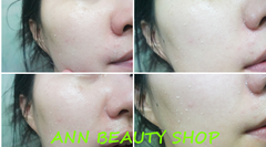Tẩy Da Chết Cho Mặt Prreti Skin Refining Peeling Gel 100g