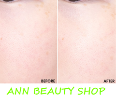 Tẩy da chết Klavuu Pure Pearlsation Revitalizing Intensive Peeling Gel