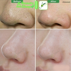 THANH LĂN MŨI TRỊ MỤN ĐẦU ĐEN MAMONDE PORE CLEAN BLACKHEAD