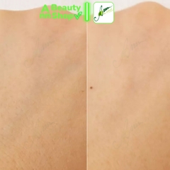 Tinh Chất Rau Má Giảm Mụn, Dưỡng Trắng Da và Phục Hồi Da Skin1004 Madagascar Centella Asiatica Ampoule 100ml (MẪU MỚI)