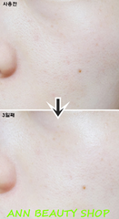 Toner Sáng Da Galactomyces Alcohol-Free Toner 150ml
