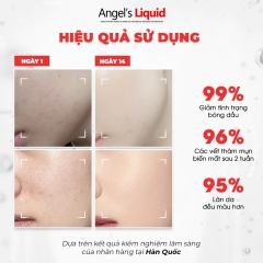 Serum Angel’s Liquid Dưỡng Trắng, Kiểm Soát Dầu, Thu Nhỏ Lỗ Chân Lông Glutathione+Niacinamide Cica 45ml