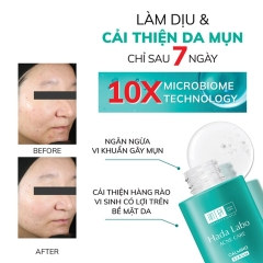 Serum Dưỡng Ẩm Cho Da Mụn, Nhạy Cảm Hada Labo Acne Care Calming 30ml