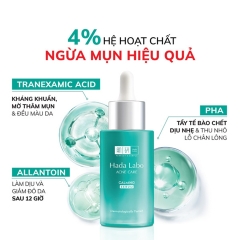 Serum Dưỡng Ẩm Cho Da Mụn, Nhạy Cảm Hada Labo Acne Care Calming 30ml