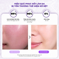 Nước Dưỡng Phục Hồi Da Tia'm Snail & Azulene Water Essence 180ml
