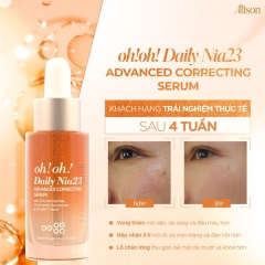 Tinh Chất Dưỡng Sáng Da, Mờ Thâm Oh!Oh! Daily Nia23 Advanced Correcting 30ml