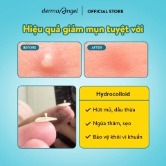 Miếng Dán Mụn Ban Ngày Derma Angel Acne Patch Original Invisible (12 Miếng)