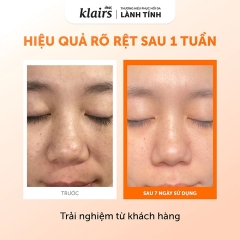 Nước Hoa Hồng Sáng Da Dear, Klairs Freshly Juiced Vitamin Essence Toner 180ml