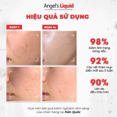 Kem Dưỡng Trắng Kiểm Soát Dầu, Thu Nhỏ Lỗ Chân Lông Angel’s Liquid Glutathione Plus Niacinamide Cica 50ml