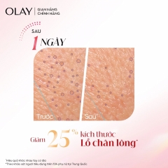 Serum Dưỡng Da Olay Siêu Dưỡng Ultra Firming 30ml