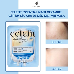 Mặt Nạ Celefit Essential Mask 23g - Ceramide