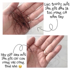 Cặp dầu gội xả Biotin của Mỹ BDGX