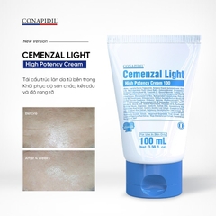Kem Dưỡng Hằng Ngày Tái Định Vị Da CONAPIDIL Cemenzal Light High Potency Cream Bản Mới [100ml]