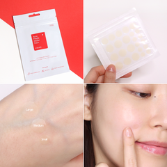 Dán Mụn Cosrx Acne Pimple Master Patch