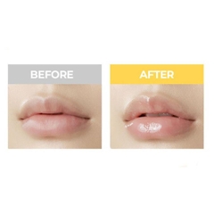 Dưỡng Môi CNP Propolis Lipcerin 15ml