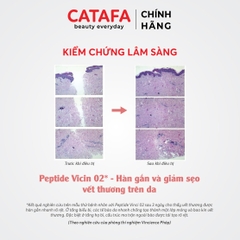 J19 Kem dưỡng ẩm, làm dịu và giảm khô da Dermal Age Defy (Light) - Jean d'Arcel