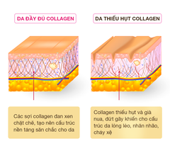 Tầm quan trọng của collagen đối với làn da