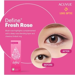 Kính Áp Tròng ACUVUE Define Fresh Rose: Lens Màu Hồng Tự Nhiên 1 Ngày Cho Mắt Cận