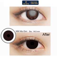 Kính Áp Tròng Thẩm Mỹ Che Khuyết Điểm Mắt 6 Tháng - Tự Nhiên Và Tự Tin