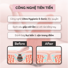 Máy Rửa Mặt Sóng Âm CRENOT NIA P5