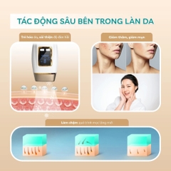 Máy triệt lông mini vĩnh viễn Crenot Graci X3 tẩy lông lạnh bikini vùng kín nữ may triet long cam tay IPL tại nhà