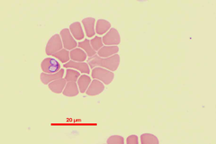 Bệnh kí sinh trùng máu Babesia spp ở chó