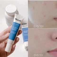 Gel Trị Mụn Murad Acne Control Rapid Relief Acne Spot Treatment (15ml)