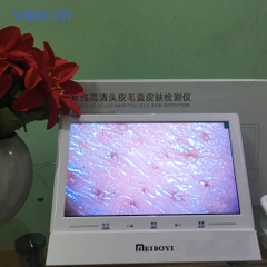 Máy soi da Meiboyi