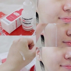 Tinh Chất Dưỡng Trắng Cấp Ẩm Phục Hồi Căng Bóng Da Medi-Peel Bio-Intense Gluthione 600 White Ampoule 30ml