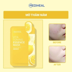 Mặt Nạ Mediheal Vita Toning Essence Mask Cấp ẩm Dưỡng Trắng 20ml