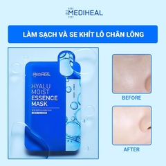 Mặt Nạ Mediheal Hyalu Moist Essence Mask Cấp Ẩm Chuyên Sâu 20ml