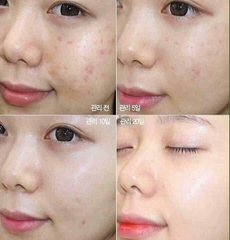 Tinh Chất rau má Skin1004 Madagascar Centella Ampoule 100ml