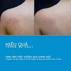 Gel Rửa Mặt & Tắm La Roche-Posay Effaclar Micro Peeling Purifying 50ml