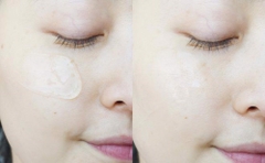 Kem Dưỡng Mờ Sẹo La Roche-Posay Cicaplast Gel B5 40ml