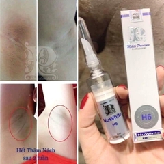 Kem Trị Thâm Nách Bẹn Mông Nuwhite H6 Mibiti Prudente 5ml