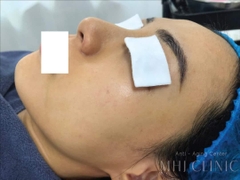 GIGI Challenging Anti Aging Treatment - Thách Thức Mọi Dấu Hiệu Lão Hóa