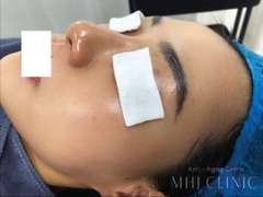 GIGI Challenging Anti Aging Treatment - Thách Thức Mọi Dấu Hiệu Lão Hóa