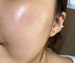 Serum cấp ẩm dịu da Volayon Hyaloten Serum