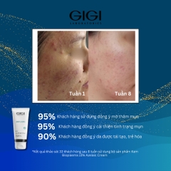 Kem Azelaic trị mụn & thâm mụn GIGI LABORATORIES Bioplasma Azelaic 15% Cream