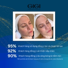 Kem Azelaic trị mụn & thâm mụn GIGI LABORATORIES Bioplasma Azelaic 15% Cream