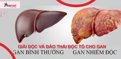 Thuốc Liver Detox Có Tác Dụng Gì? Cách Nó Hoạt Động