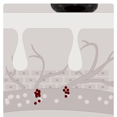 Máy cạo và giác hơi thông minh Xiaomi LERAVAN RSW-328